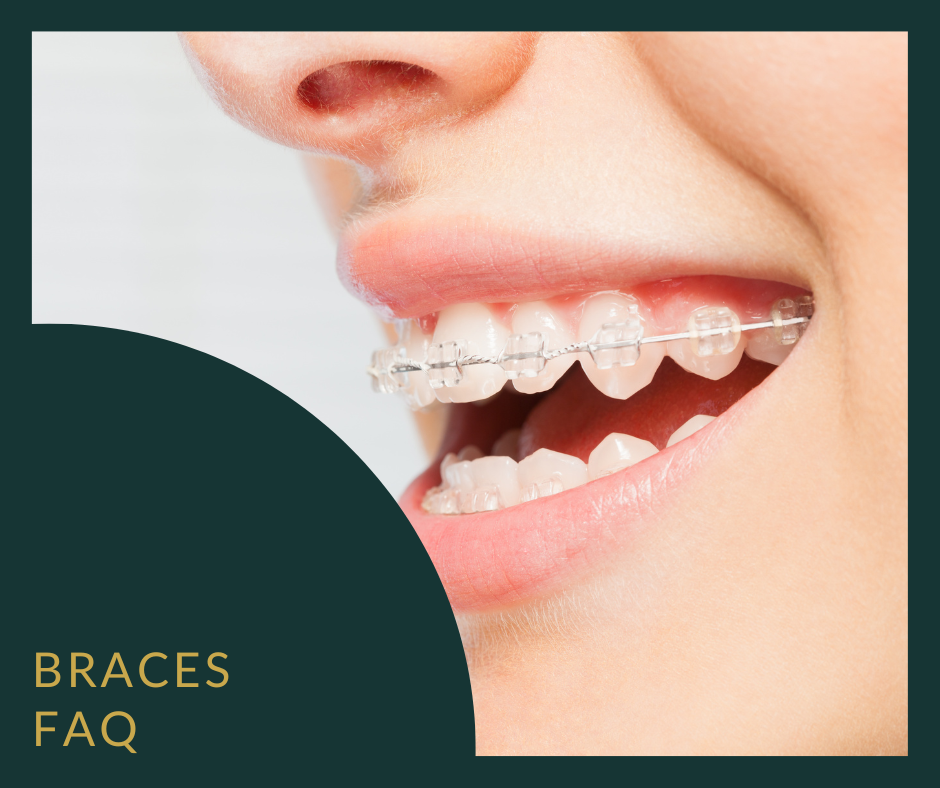 Borders Braces FAQ 5